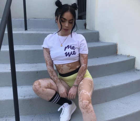 Instagram User Responds to Bullying By Creating Body Art