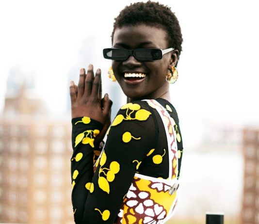 This Girl Was Once Bullied for her “Ugliness”. Today She’s a Supermodel