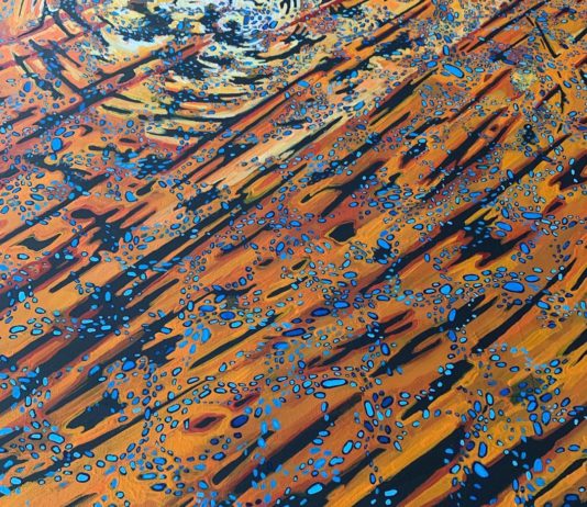 Artist Creates Paintings Inspired By Her Chronic Migraines